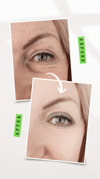 ORGANIC UNDER EYE YOUTH CORRECTOR - For Women-1